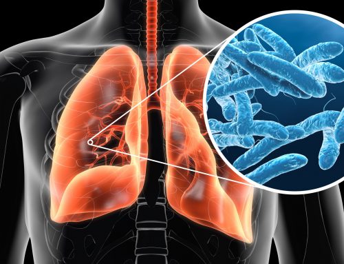 Woche 13: Legionellenprävention in Warmwassersystemen – Wie Sie Gesundheitsrisiken vermeiden